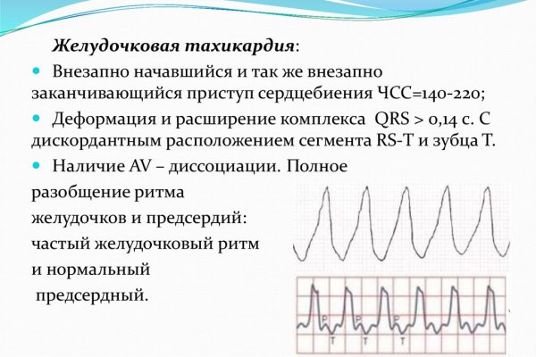 Кракен даркнет поддержка